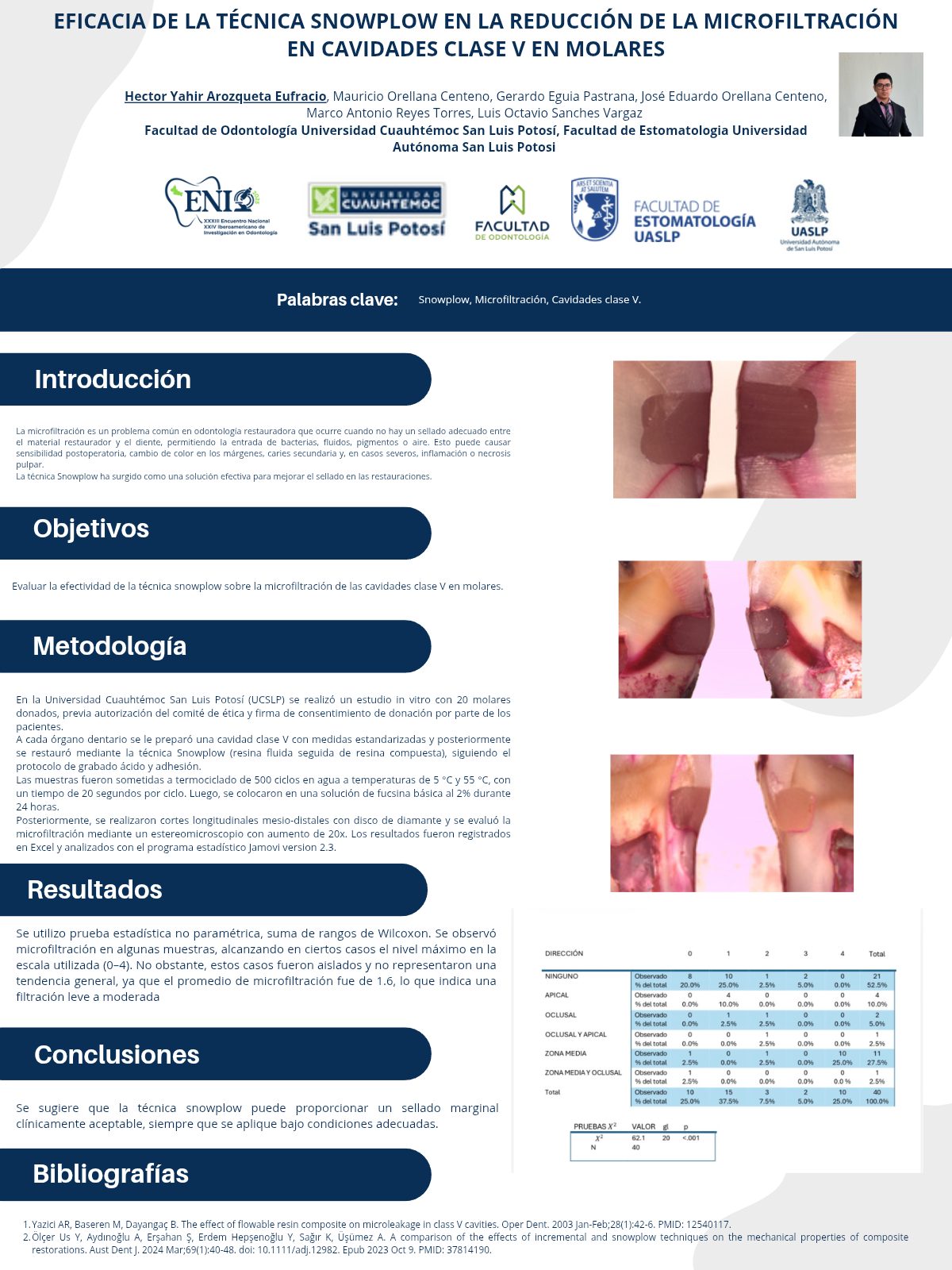 Cartel: Eficacia de la técnica snowplow en la reducción de la microfiltración en cavidades clase v en molares