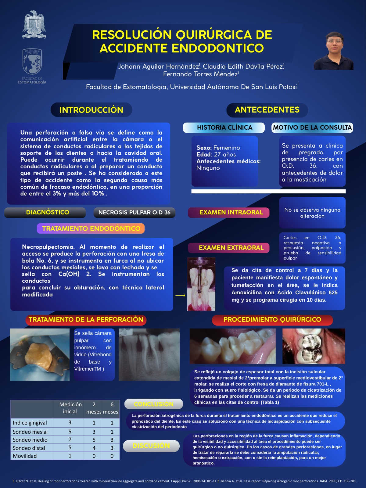 Cartel: Manejo Endodontico de Premolares con Variaciones Endodónticas