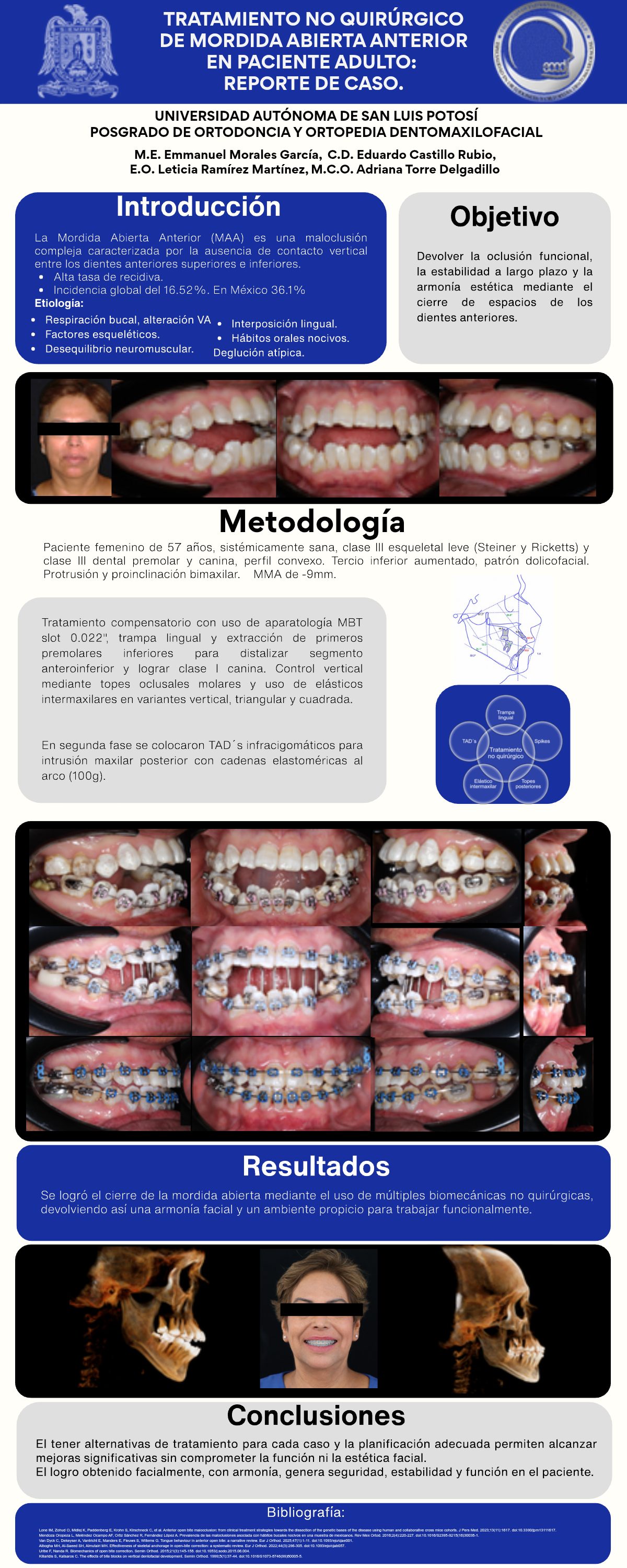Cartel: Tratamiento no quirúrgico de mordida abierta anterior en paciente adulto. Reporte de caso