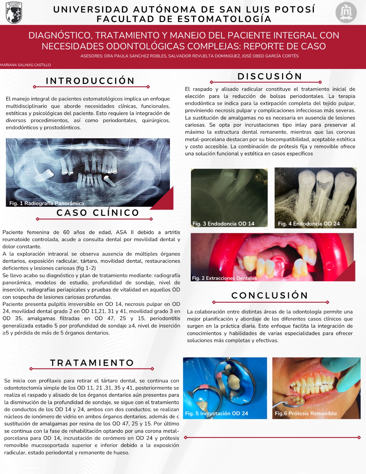 Cartel: DIAGNÓSTICO, TRATAMIENTO Y MANEJO DEL PACIENTE INTEGRAL CON NECESIDADES ODONTOLÓGICAS COMPLEJAS: REPORTE DE CASO