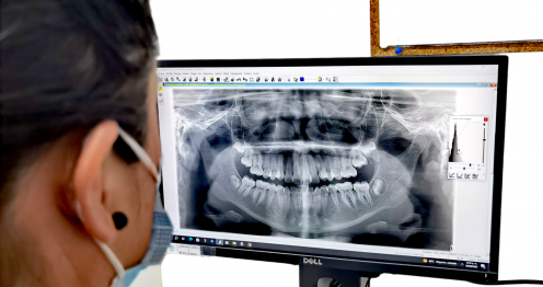 Radiología dental, Tomografía dental, Odontología moderna, Imagenología, Rayos X