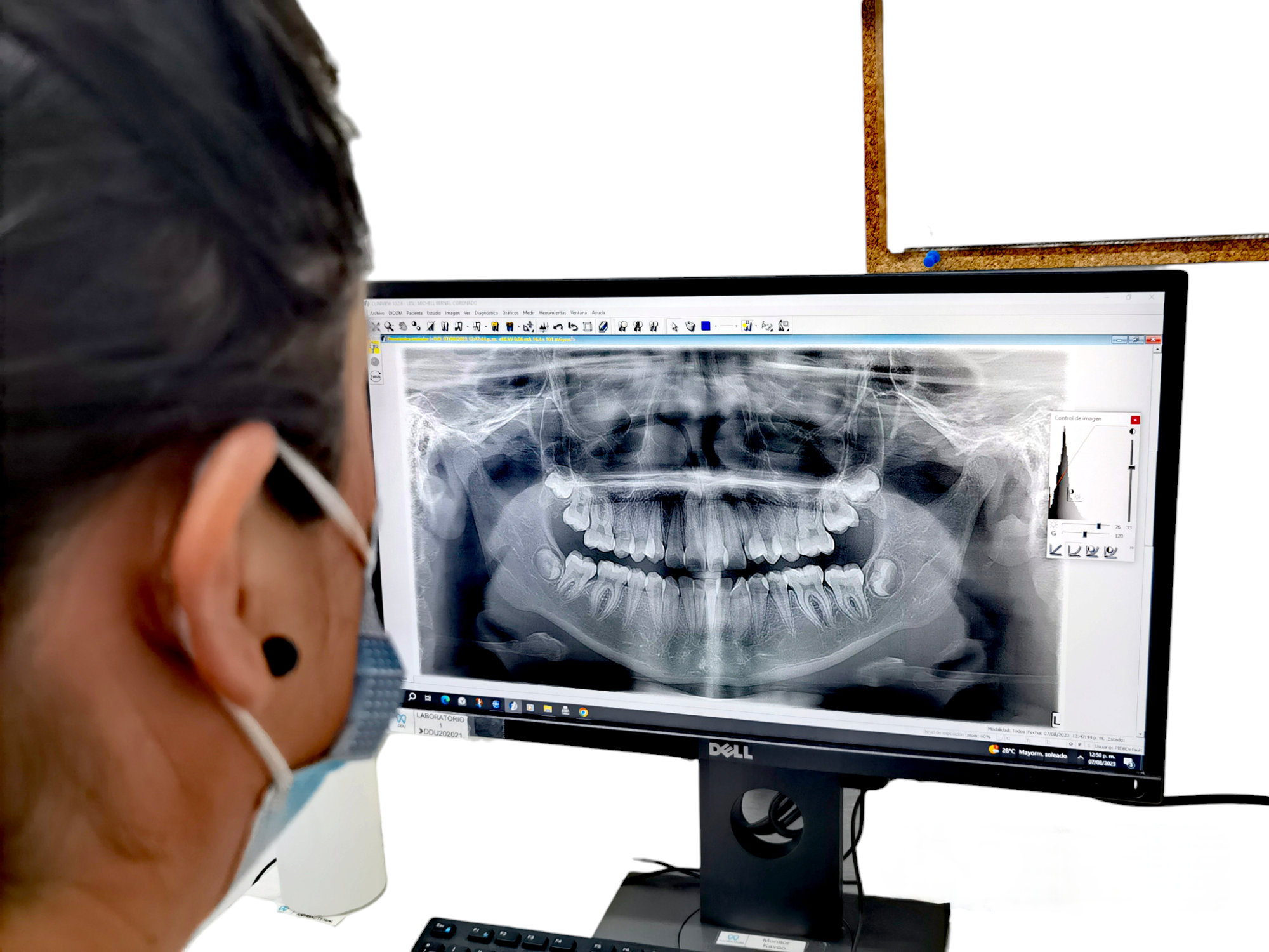 Radiología dental, Tomografía dental, Odontología moderna, Imagenología, Rayos X